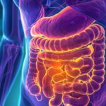 Preventing Colon Cancer