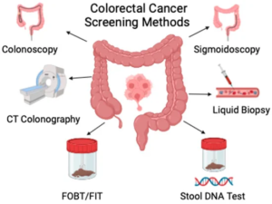 Colorectal Cancer