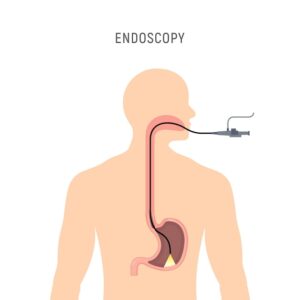 Endoscopy
