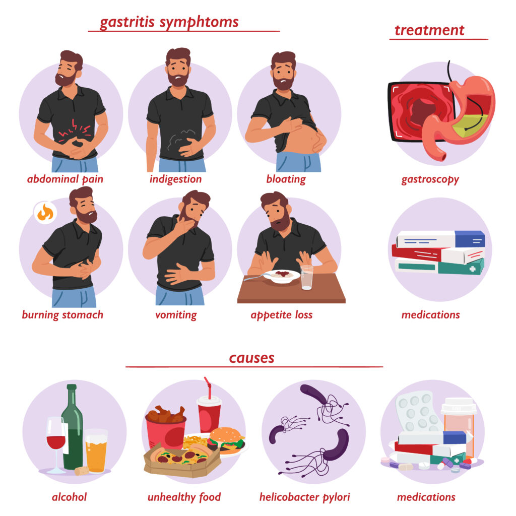 Common Gastrointestinal Disorders