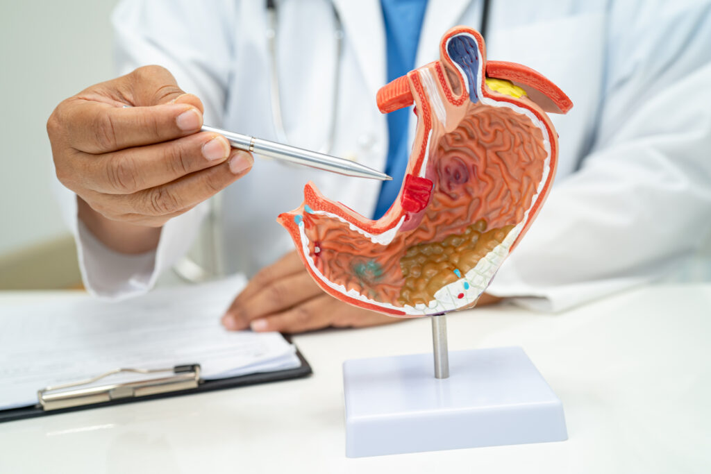 Gastroenterology care