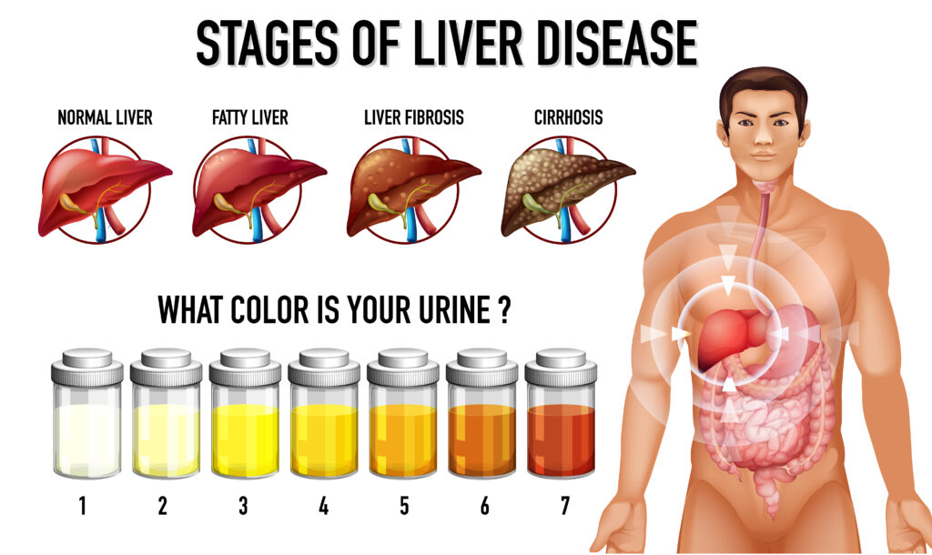 early sign of liver problems