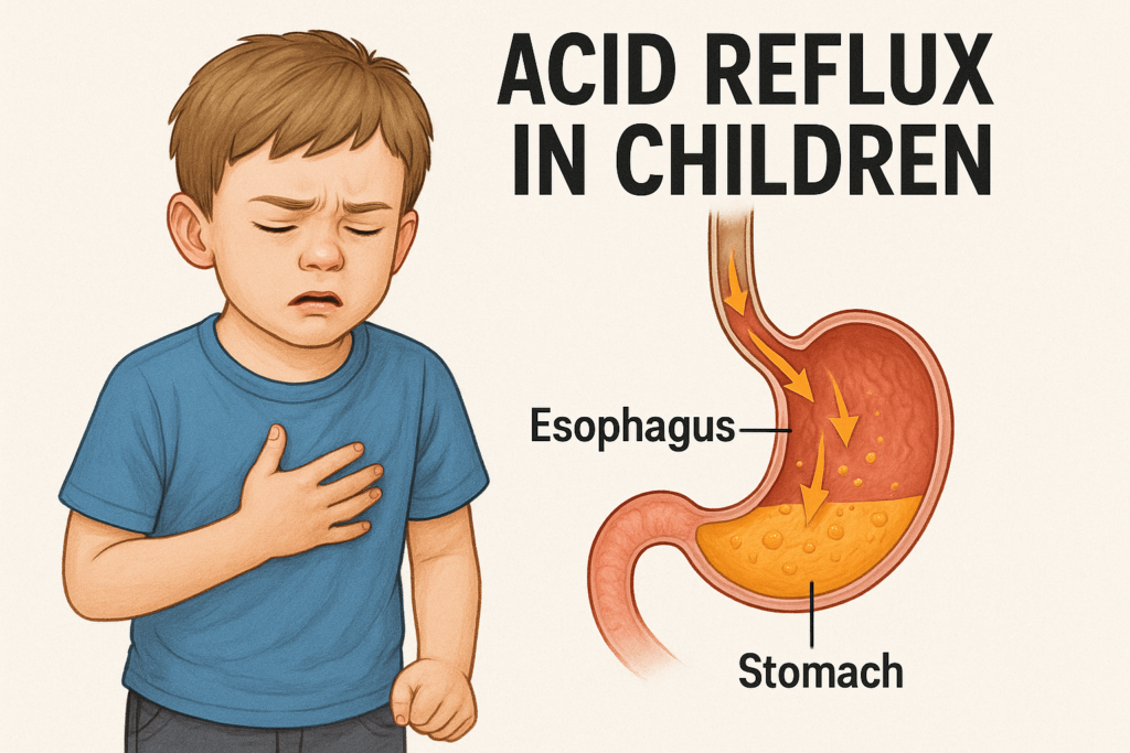 acid reflux in children