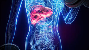 Liver Disease